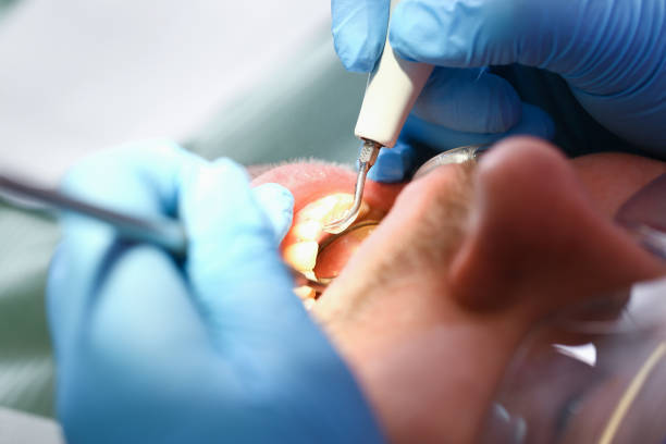 Best Mobile Emergency Dentist in Louisville, TN