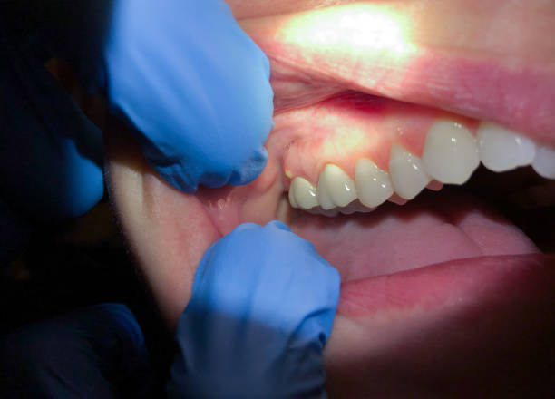 Best Holiday Emergency Dentist in Louisville, TN