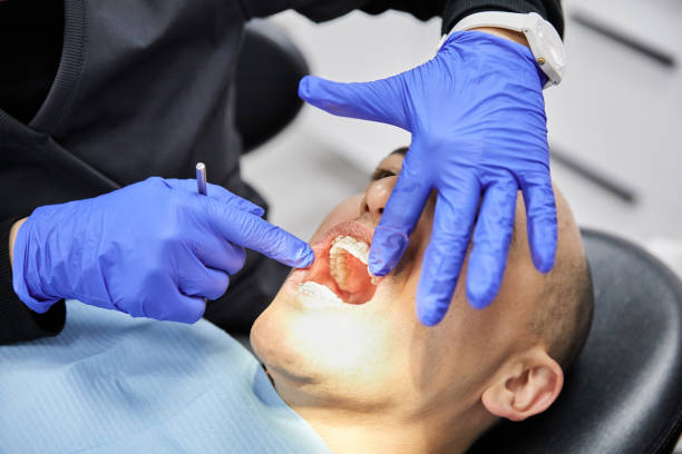 Best Emergency Dental Extractions in Louisville, TN